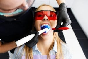Dental Cleaning 101