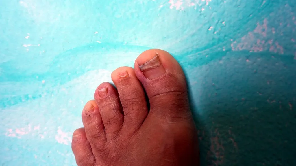 The nails and the skin of the foot are not in good condition.