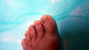 The nails and the skin of the foot are not in good condition.
